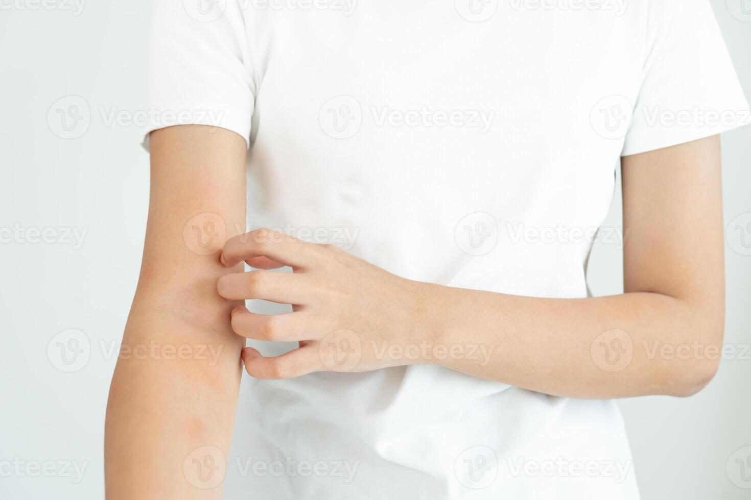 skin problem and beauty. Young woman scratch body has itchy skin from skin allergic, steroid allergy, sensitive skin, red from sunburn, chemical allergy, rash, insect bites, Seborrheic Dermatitis. photo