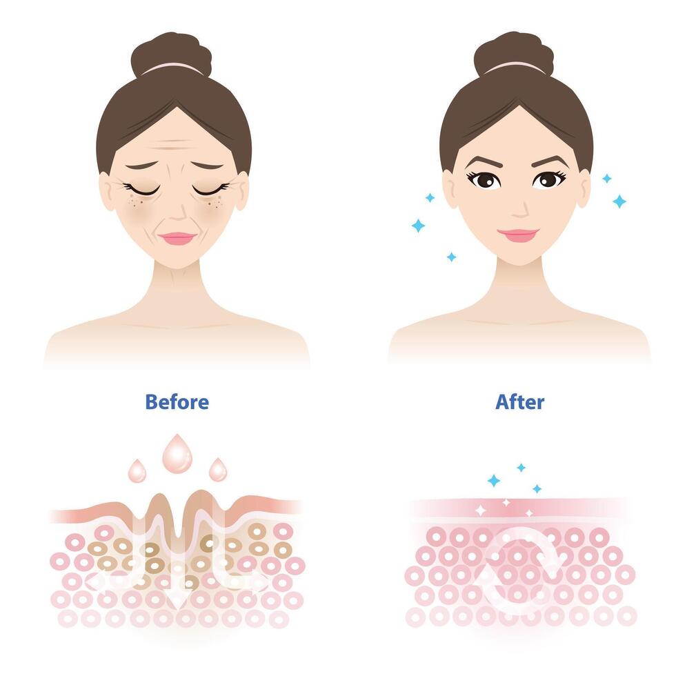 Comparison of woman face before and after wrinkle skincare absorption illustration on white background. Cross section of wrinkles skin and skincare absorbing to help reduce aging and damaged skin. vector