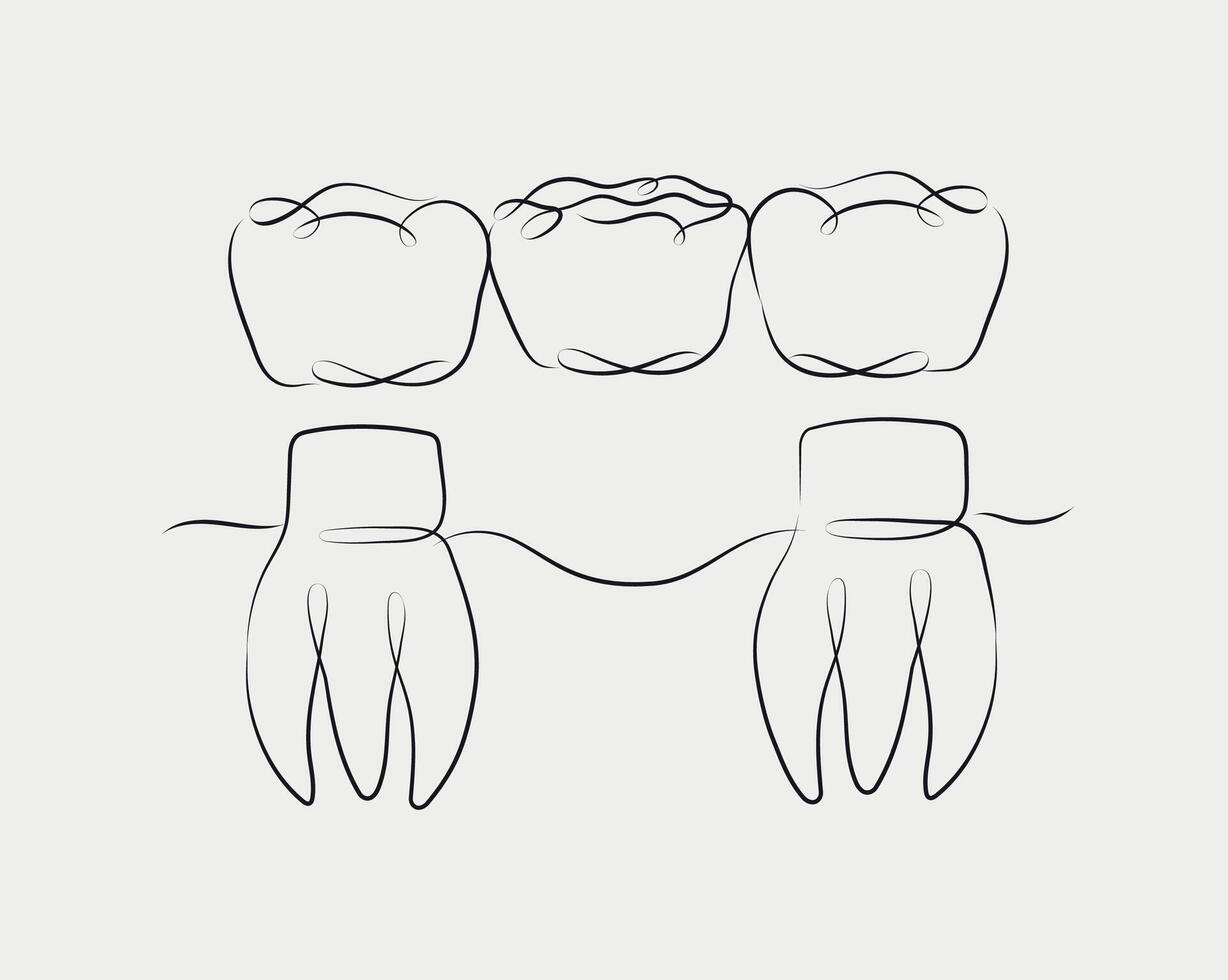 Teeth with crown bridge illustration drawing in linear style on white background vector