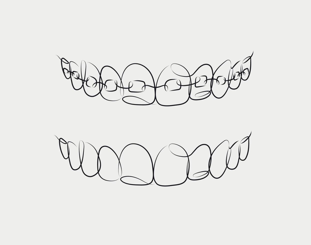Jaws with and without braces installed drawing in linear style on white background vector