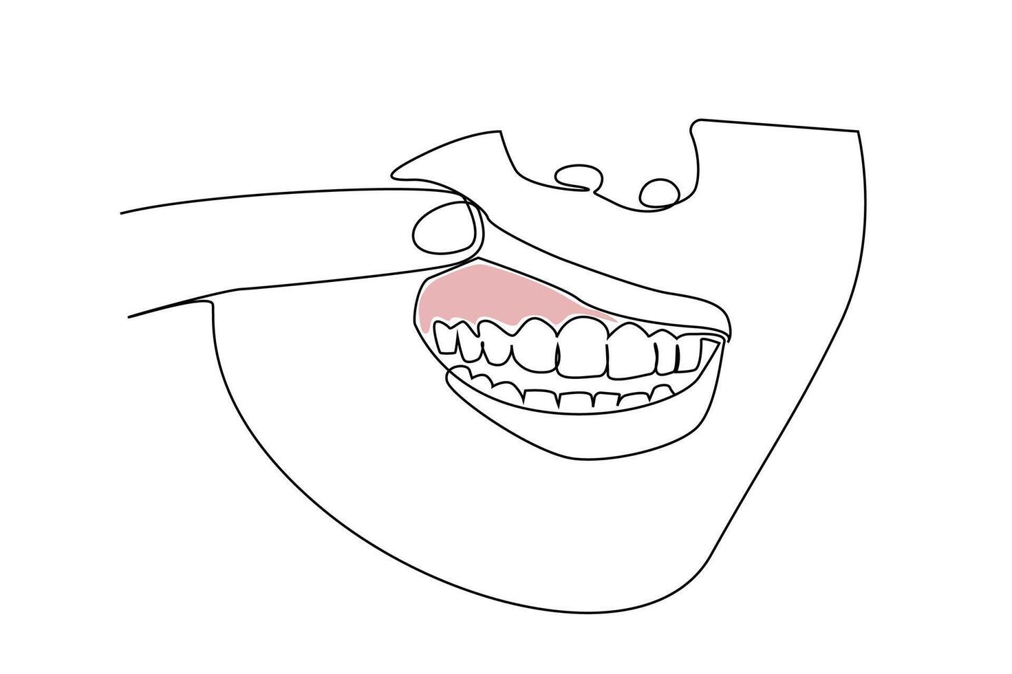 woman mouth oral dental disease gum reddened disease line art vector