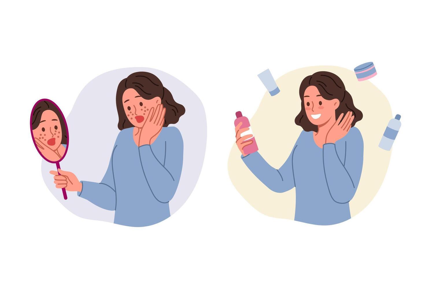 Teenage girl with acne on face holds mirror and cream to get rid of traces of hormonal explosion vector