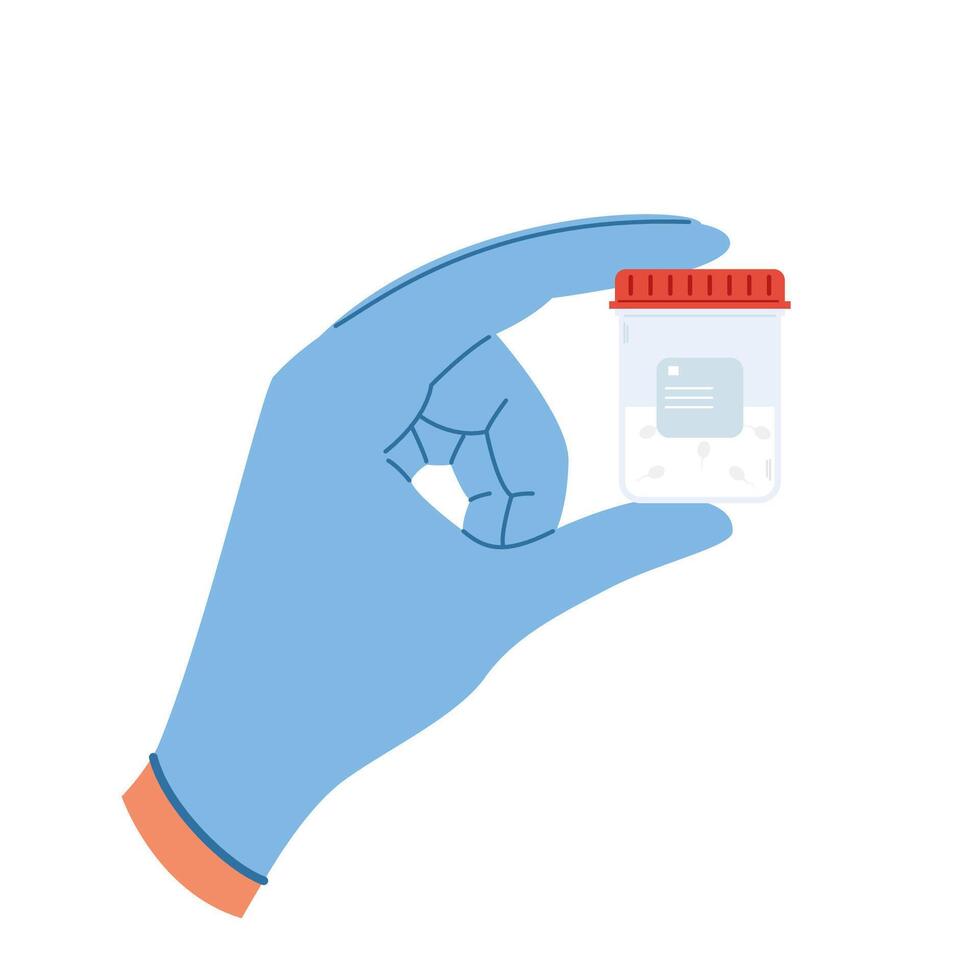 Doctor hand in rubber gloves hold container with semen analysis. Laboratory tube vector