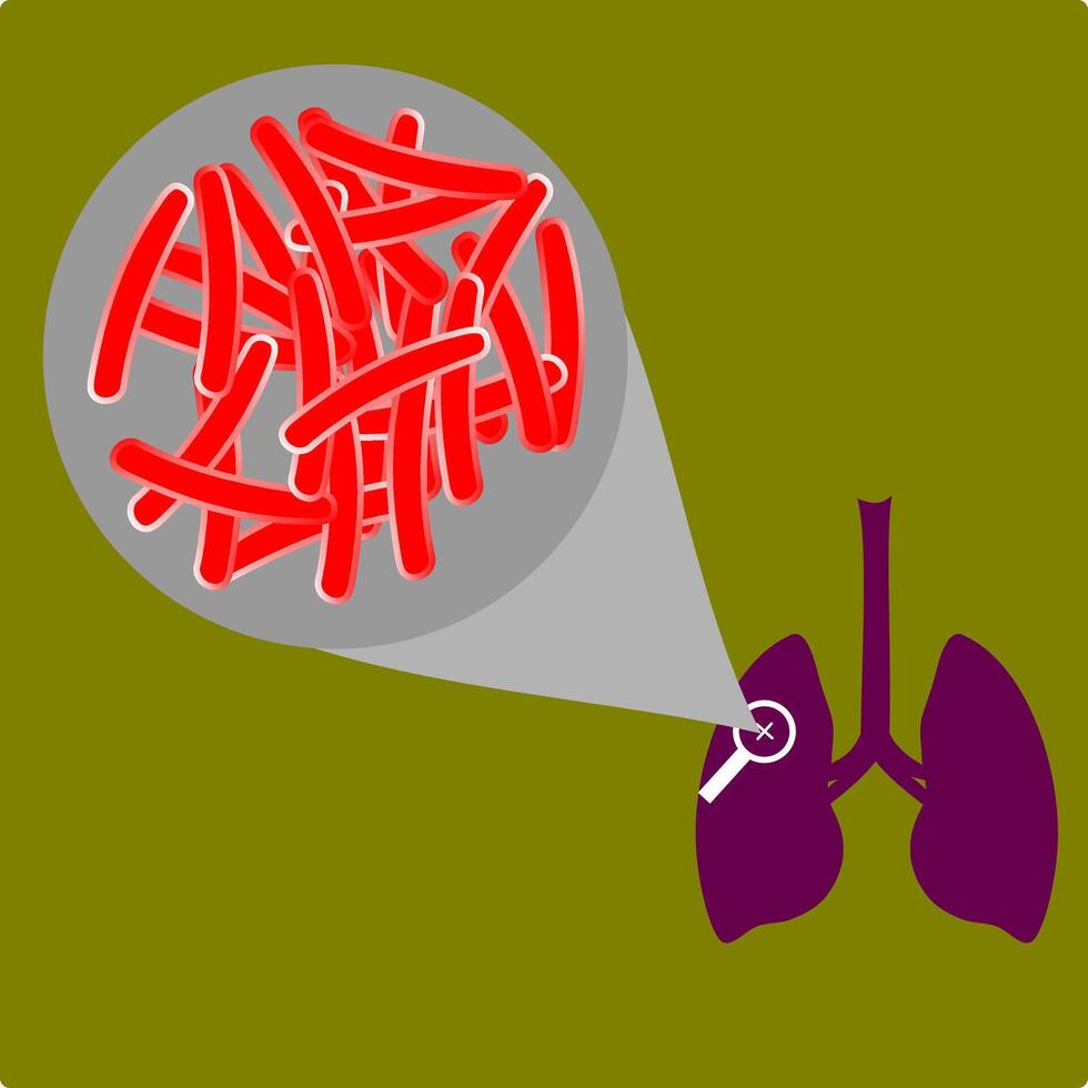 illustration of tuberculosis or TB bacteria that attack the lungs. vector