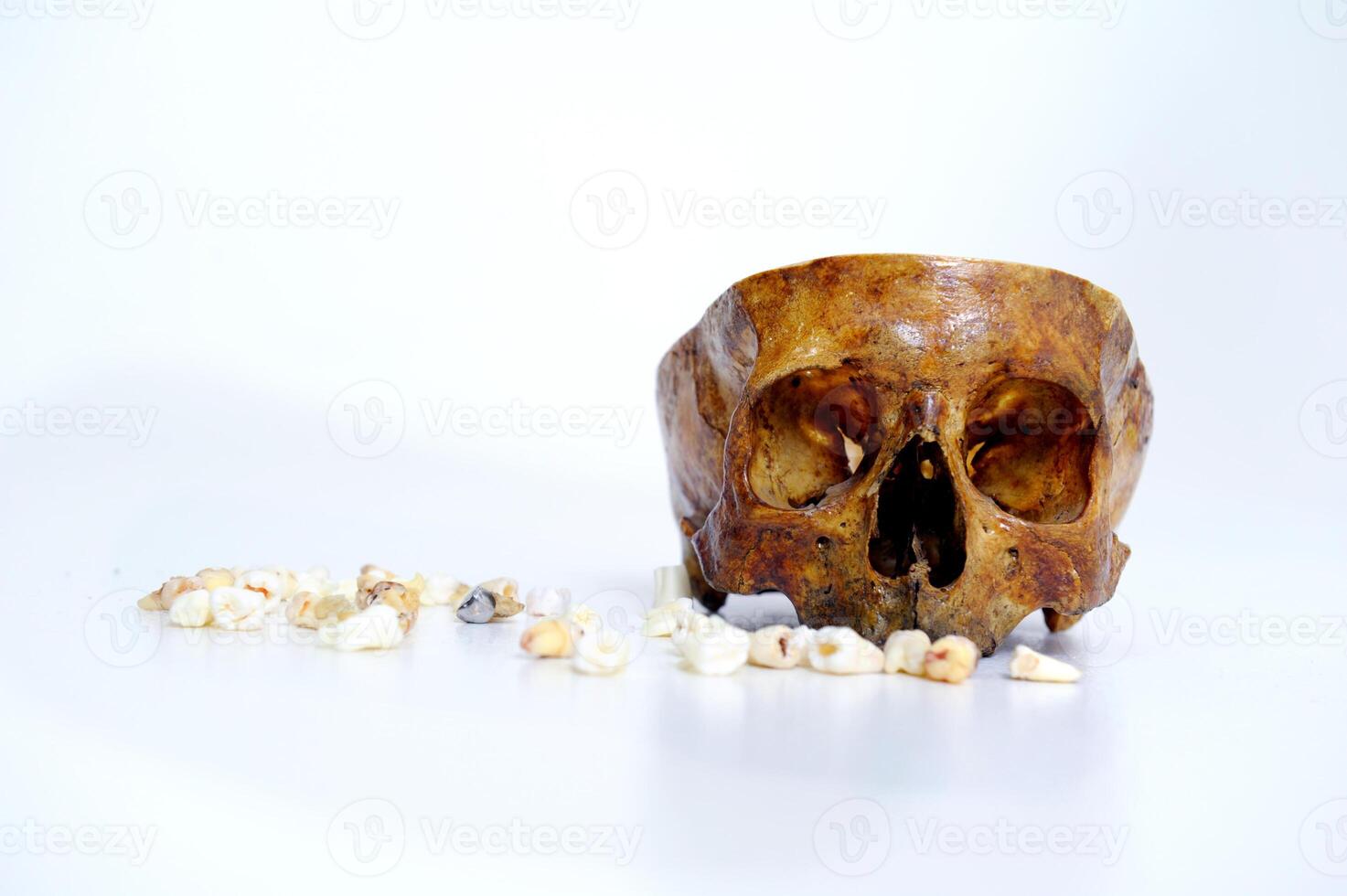 Dental equipment holding an extracted tooth Educational model with post of dental implant between teeth human skull and crowns on table indoors photo