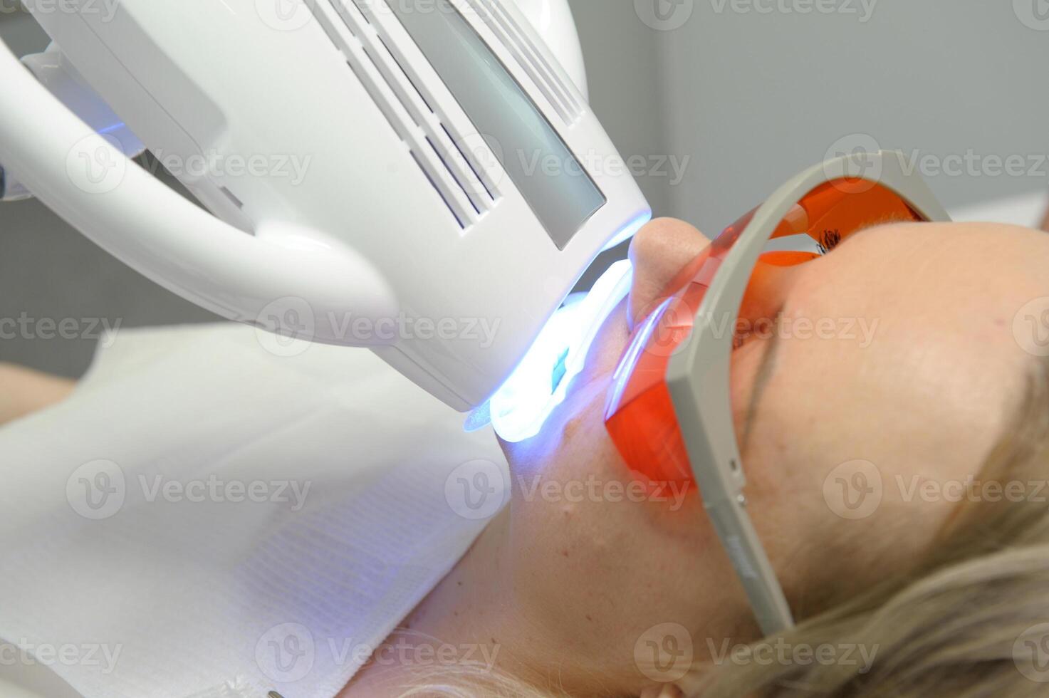 close-up of a woman's face under the apparatus Beyond Poluse Plus Advanced Whitening System with Dental UV Laser Whitening Device in glasses protective against ultraviolet whitening teeth photo