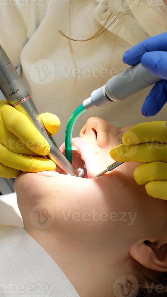 A professional dentist, a specialist, a man, examines and checks the oral cavity of a female patient, prevents caries and conducts a scheduled dental examination photo