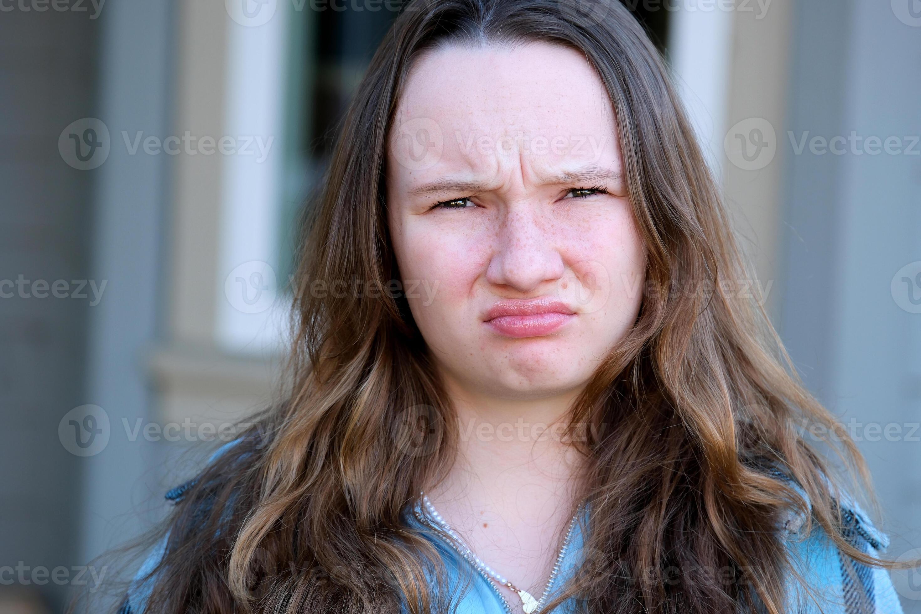 Unhappy Brows? Discover The Condition Behind Your "Sad Face" - 52jsp6a