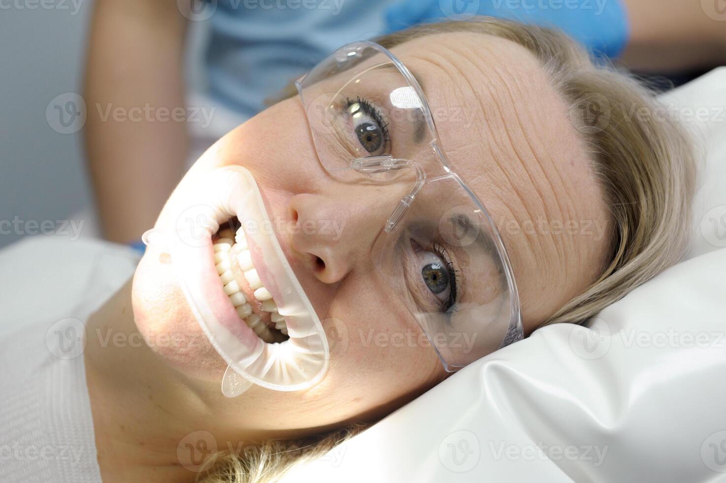 optragate mouthpiece woman in dental chair with retractor on mouth holding lips transparent glasses opens grimaces making faces smiling cheerful dentistry funny close-up of woman's face white pillow photo