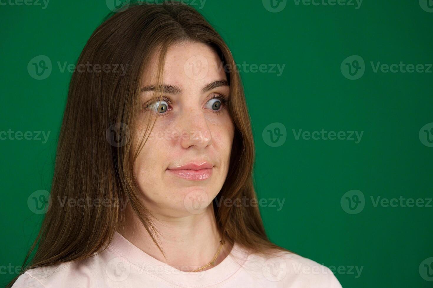 Macro closeup of young woman face with Grave's disease hyperthyroidism symptoms of ophthalmopathy bulging eyes proptosis edema photo