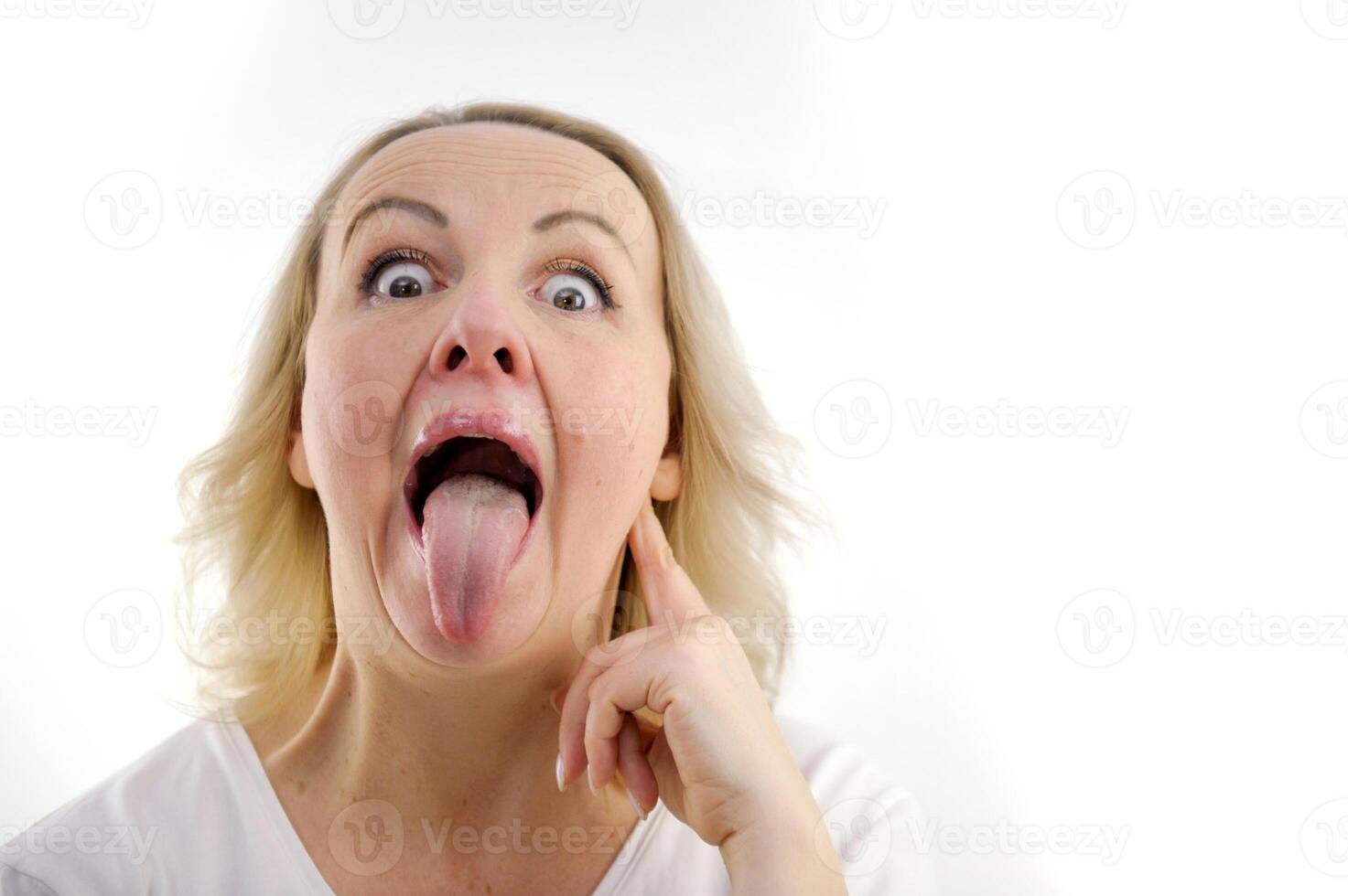 a woman shows her tongue healthy clean tongue Female tongue with a white coating. isolated on white background. Gastrointestinal disease, organ dysfunction, poor oral hygiene, fungal infections photo