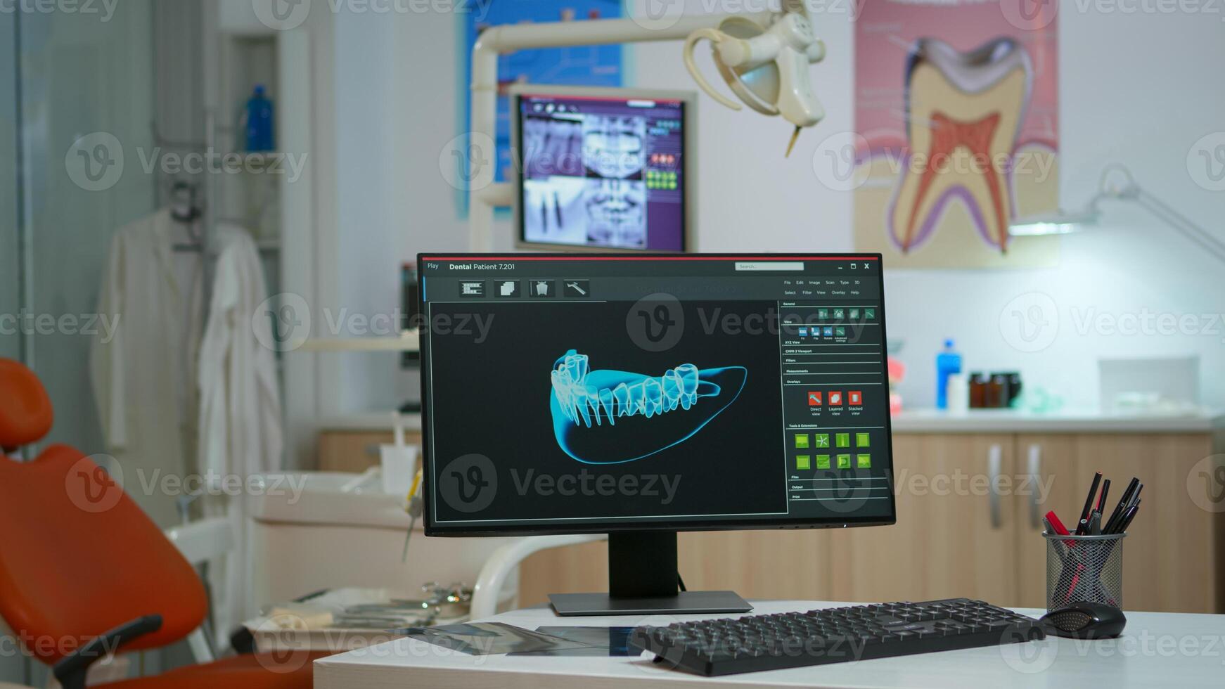 Empty dentistry medical room with digital x-ray on computer in modern equipped office. Stomatology clinic with nobody in prepared for next patient with radiograph displayed on computer screen photo