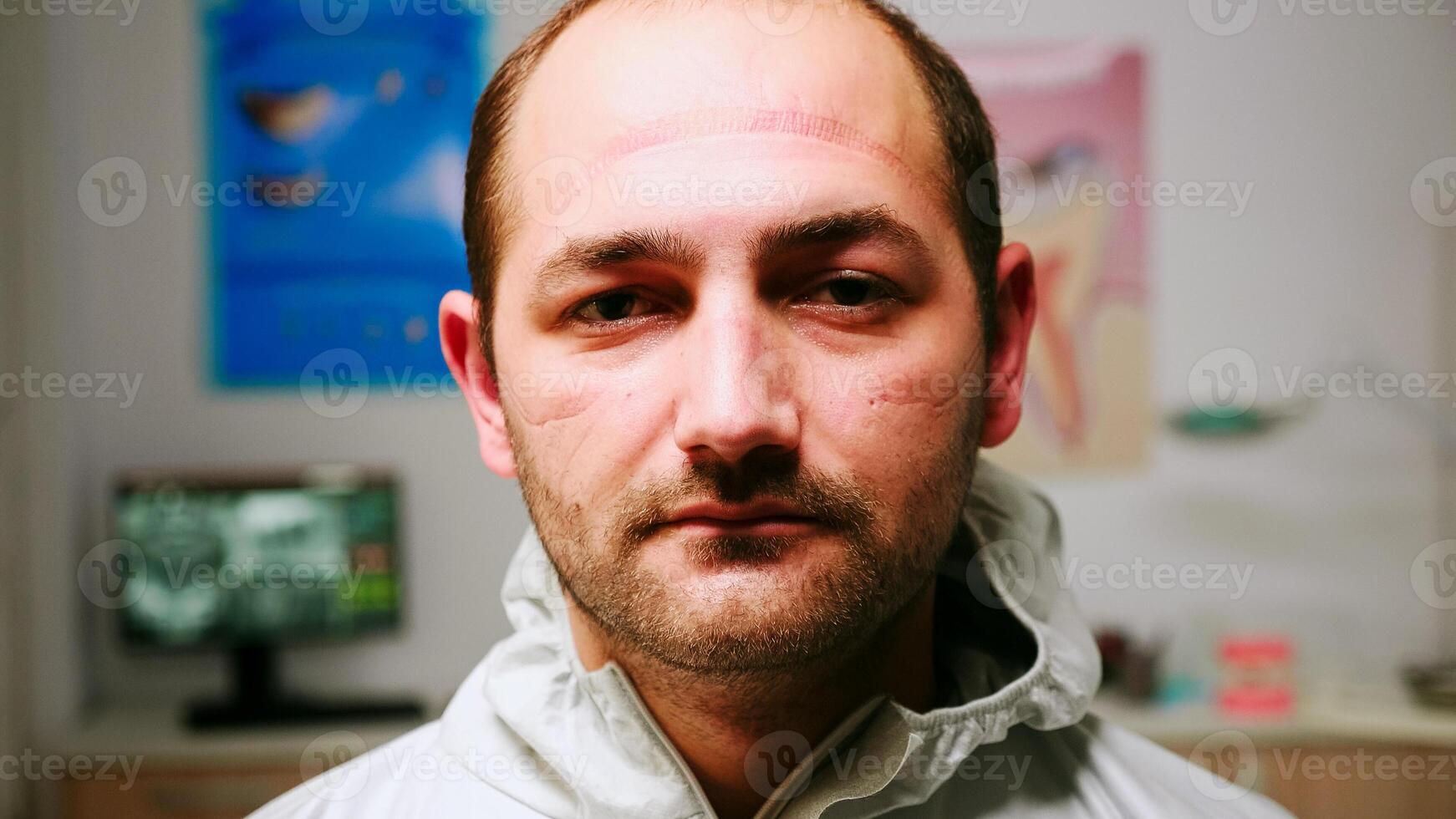 Close up of tired pediatric dentist man with marks on face because of protection mask looking at camera exhausted sitting in new normal dental office. Medical team wearing ppe suit and gloves photo