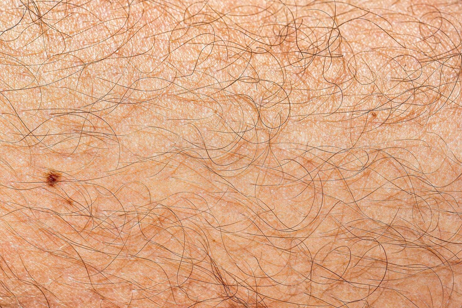 Human skin covered with hair. photo