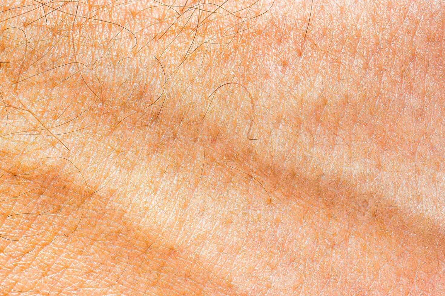 The texture of the skin of the hand. photo
