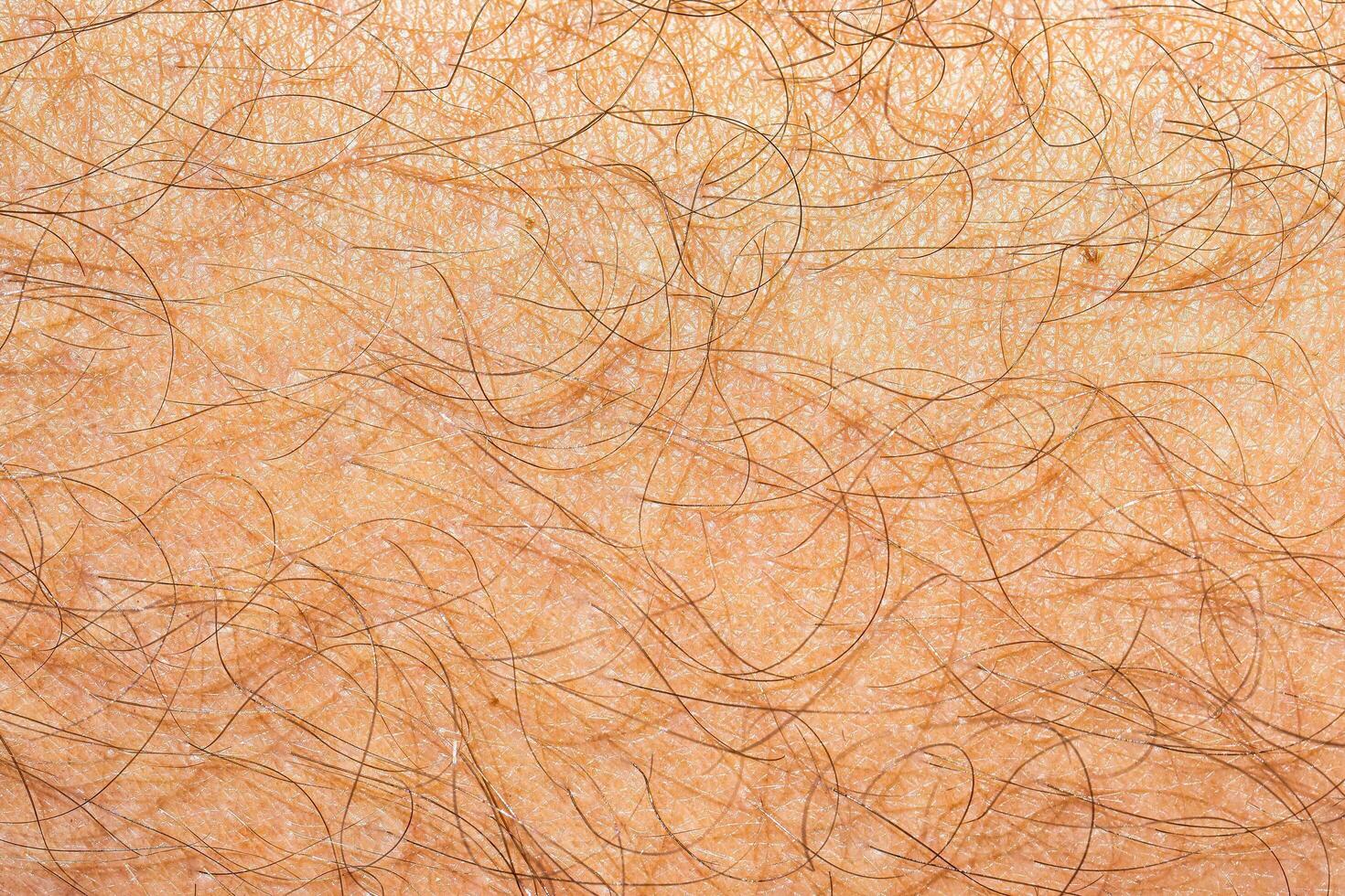 Human skin covered with hair. photo