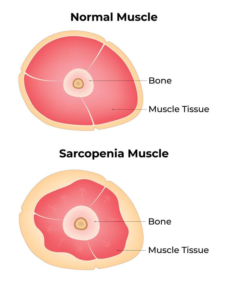 Normal Muscle Science Design Illustration Diagram vector
