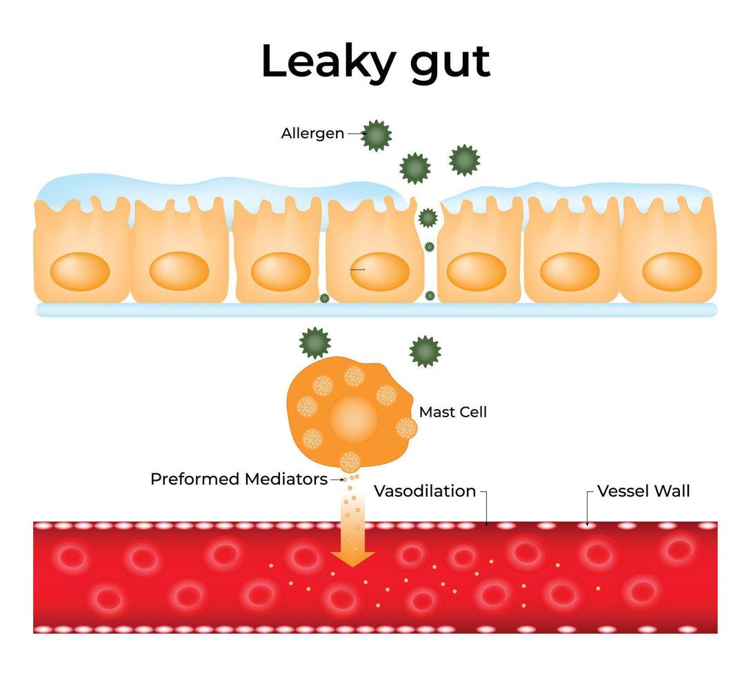 Leaky Gut Science Design Illustration Diagram vector