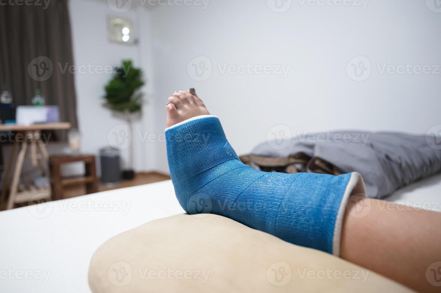 Woman accident with bone fracture foot in plaster cast resting on the bed photo