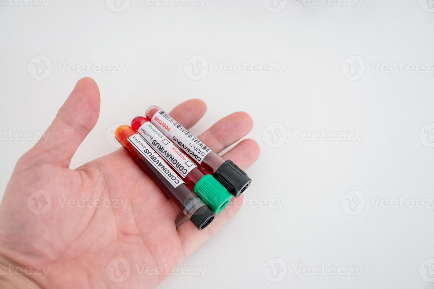 Sample of blood test tubes on chemist palm for diagnosis coronavirus, covid-19 infection in the lab photo