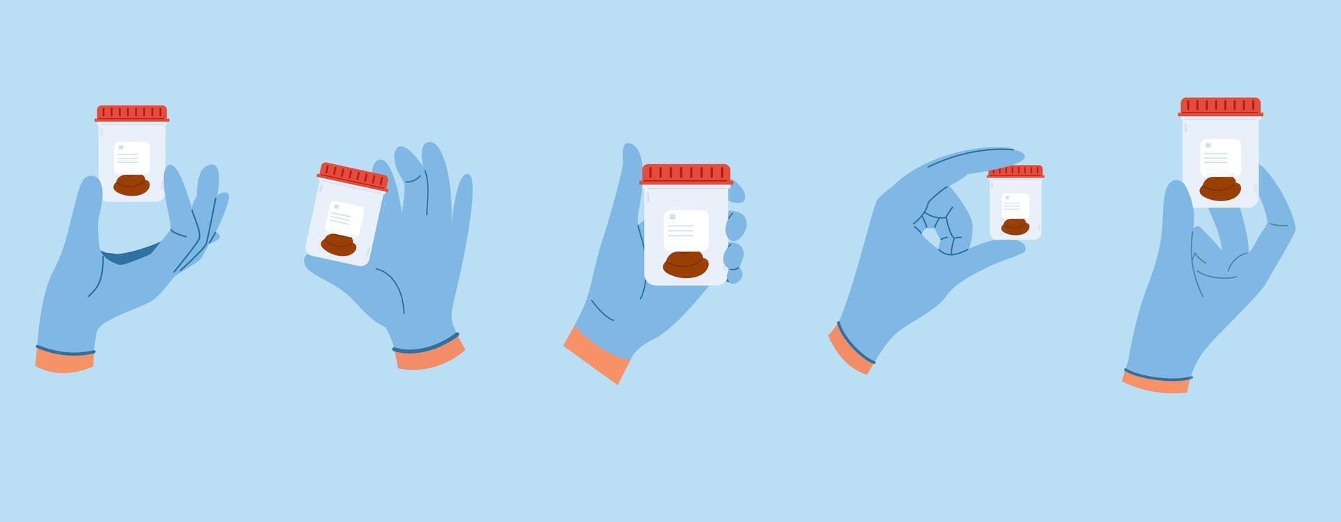 Set of illustrations with stool analysis. Doctor hands in blue gloves hold containers with poop sample vector
