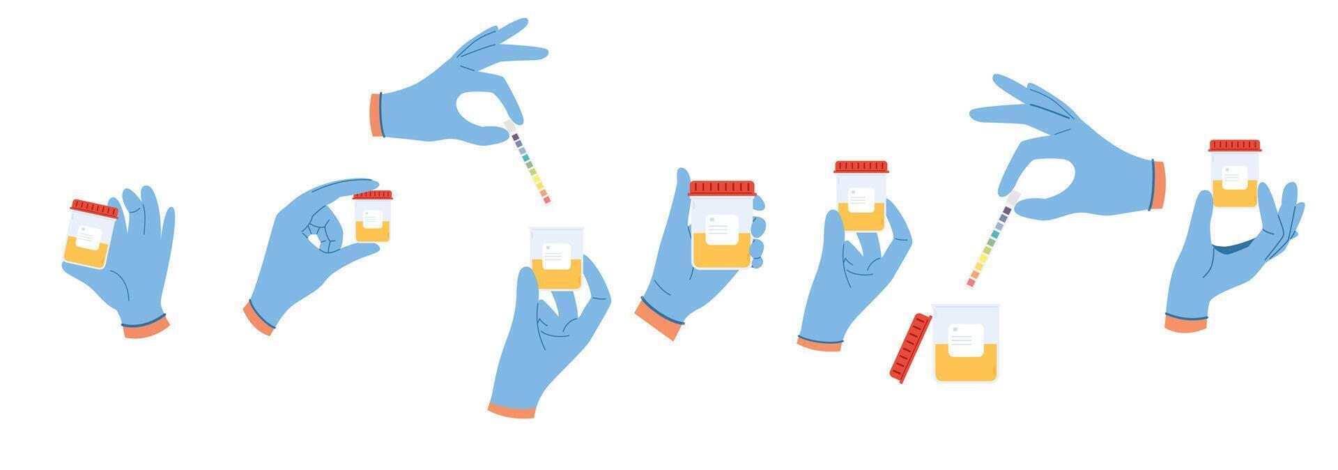 Set of illustrations with urine analysis. Doctor hands in blue gloves hold containers with pee sample vector