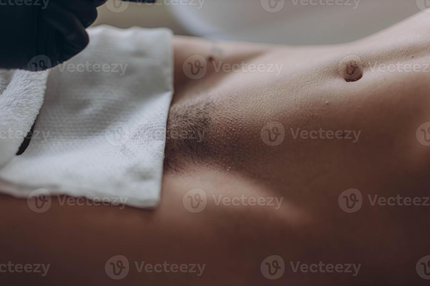 Bikini waxing,Intimate waxing, Hair removal, bikini area. Cosmetic Beauty Clinics photo