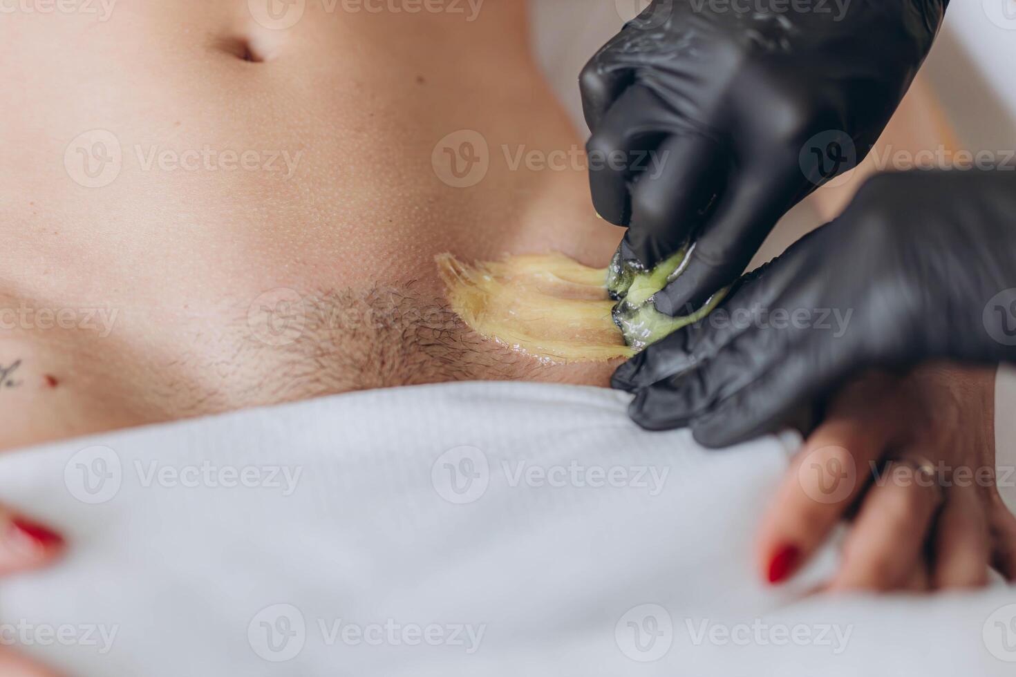 Bikini waxing,Intimate waxing, Hair removal, bikini area. Cosmetic Beauty Clinics photo