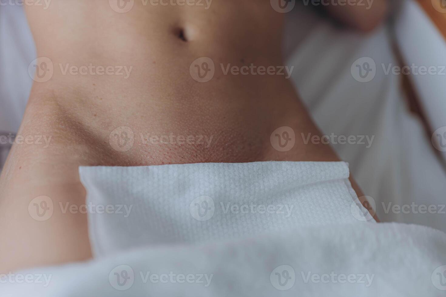 Bikini waxing,Intimate waxing, Hair removal, bikini area. Cosmetic Beauty Clinics photo