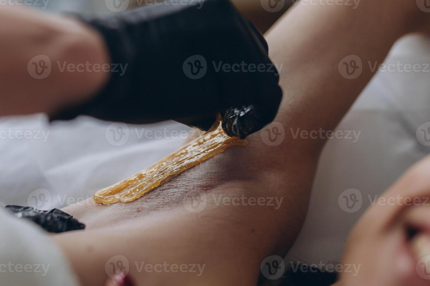 Sugaring. epilation with liquate sugar at armpit. photo