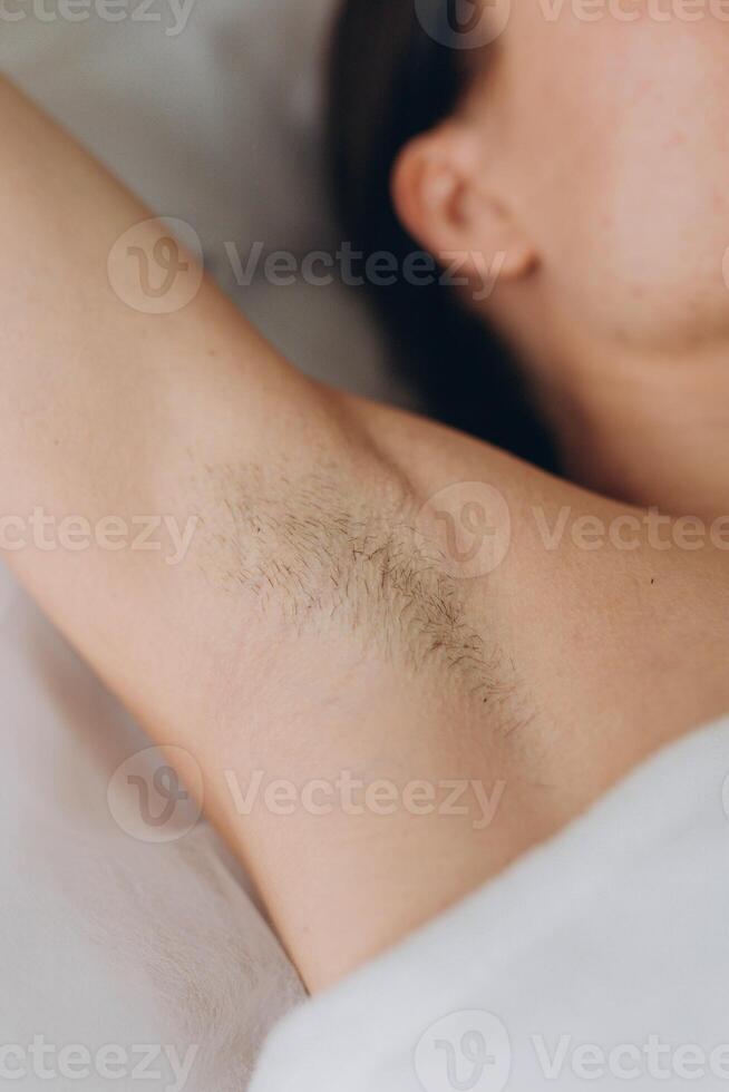 Sugaring. epilation with liquate sugar at armpit. photo