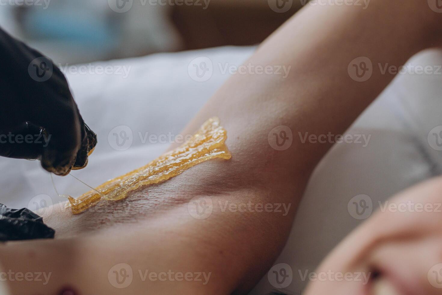 Sugaring. epilation with liquate sugar at armpit. photo
