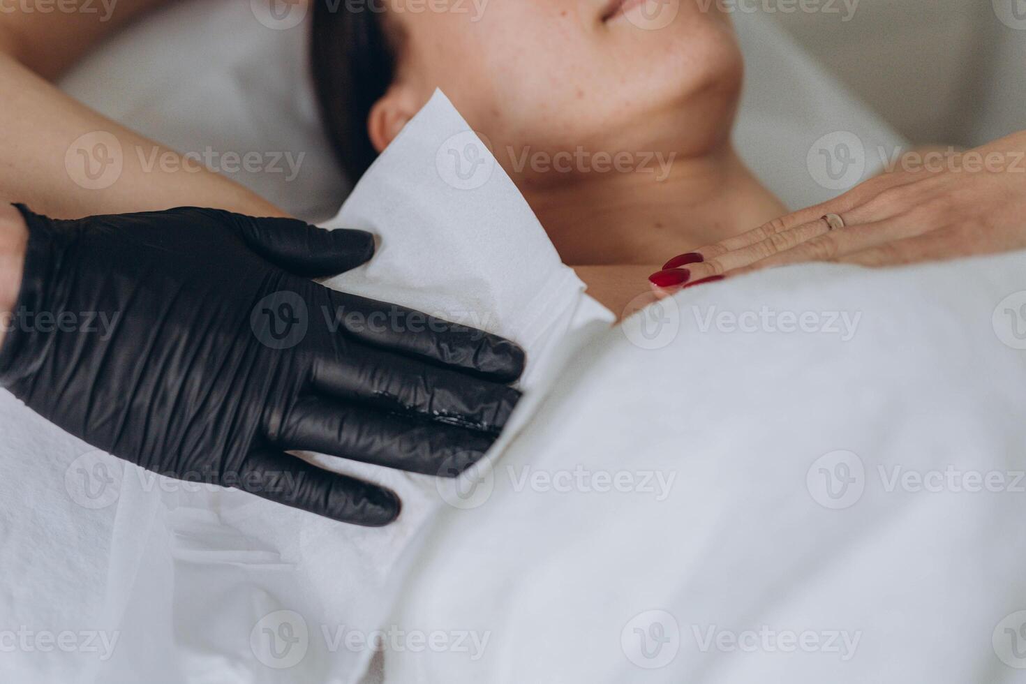 Sugaring. epilation with liquate sugar at armpit. photo