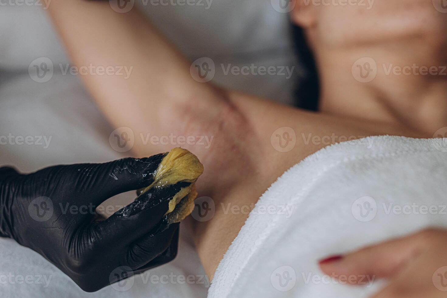 Sugaring. epilation with liquate sugar at armpit. photo