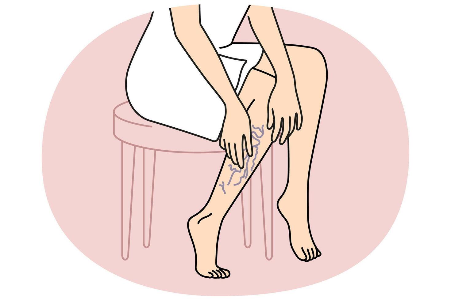 Woman touching legs with varicose veins vector