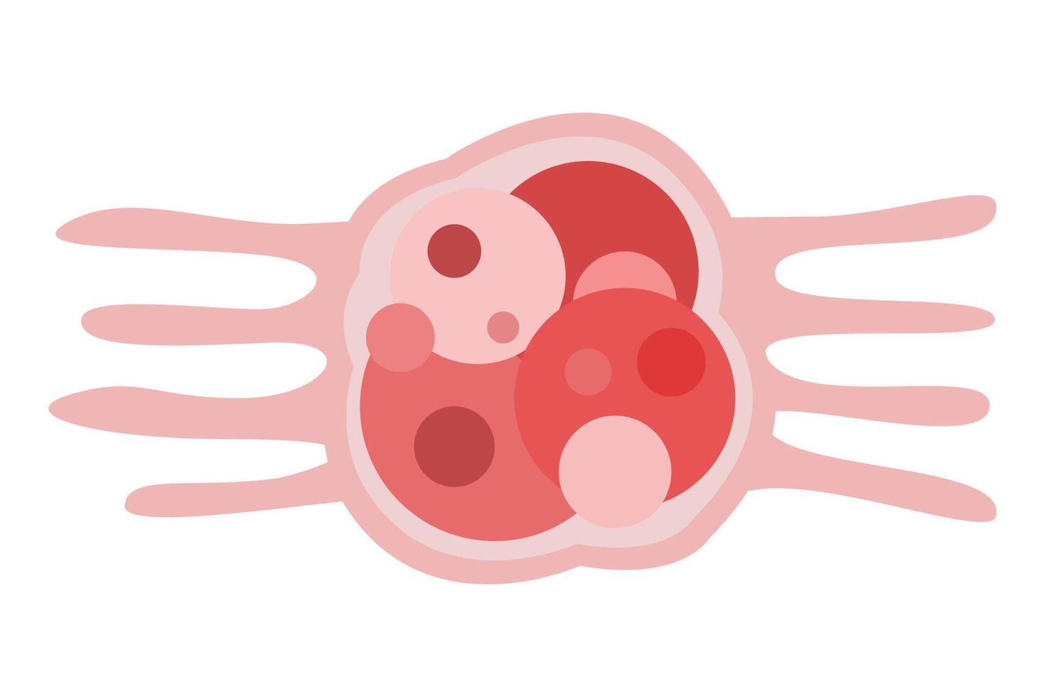 cancer cell growth. cancer disease concept vector