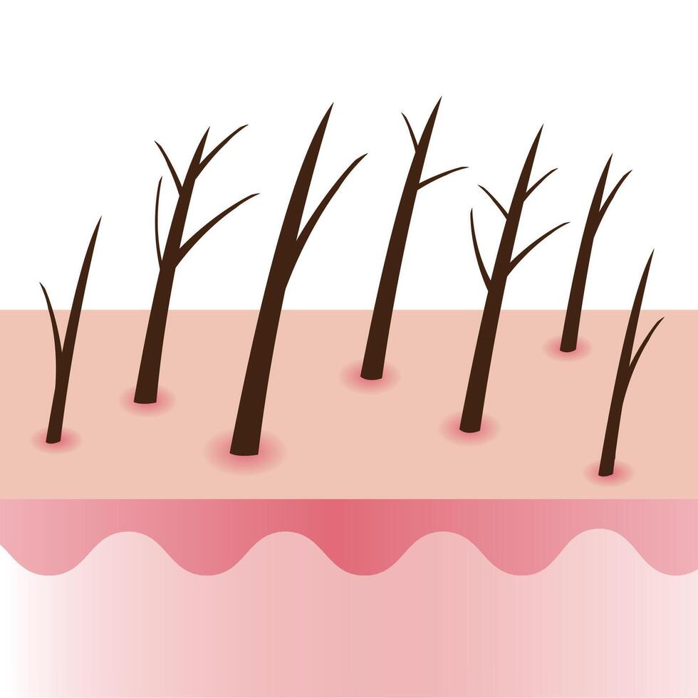 Damaged and split ends hair on scalp layer illustration isolated on white background. Dryness, baby split, y split, incomplete, knot, taper, tree and feather. Hair care and problem concept. vector