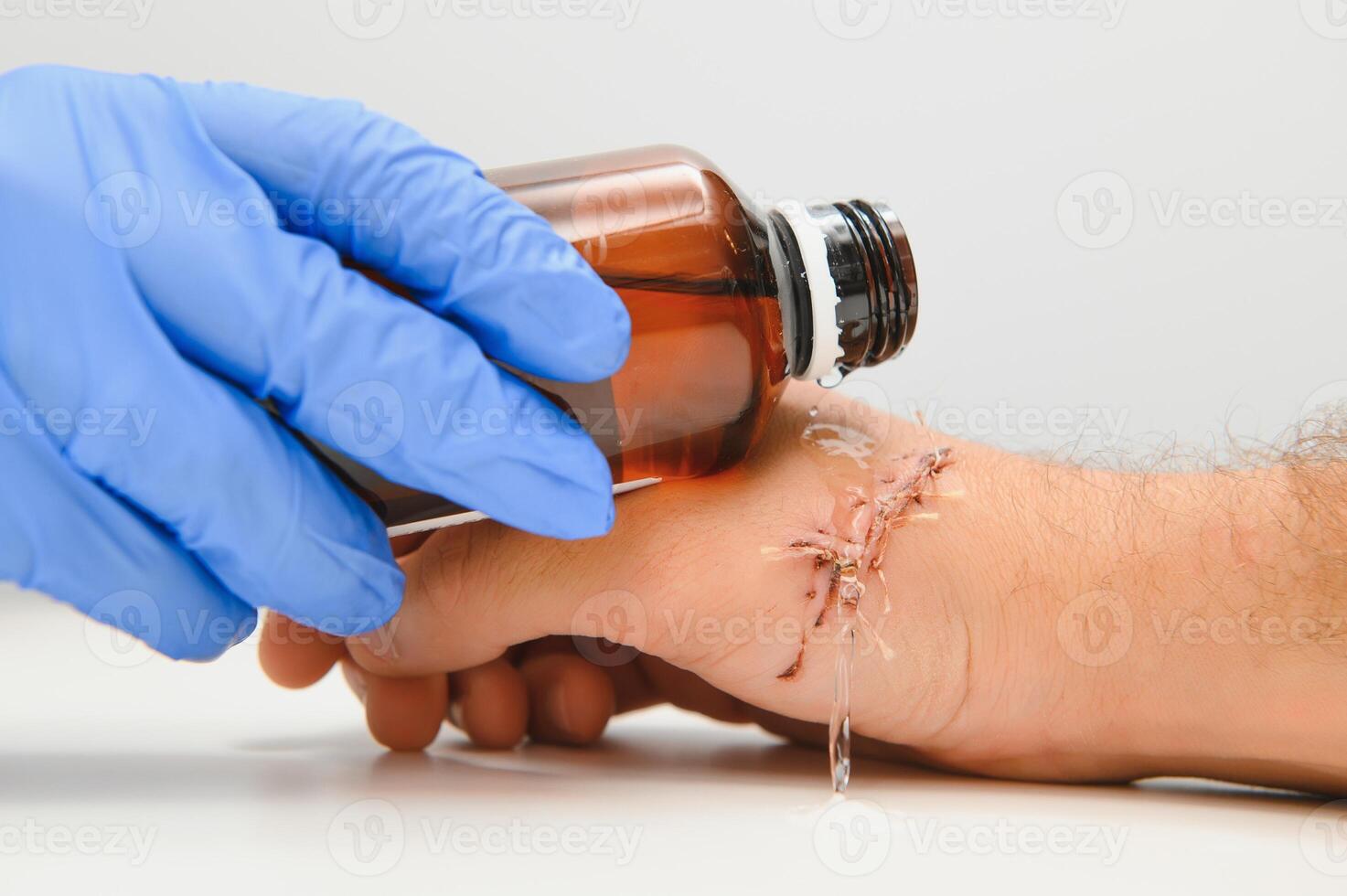 Examination and care of postoperative sutures on the patient's shoulder photo