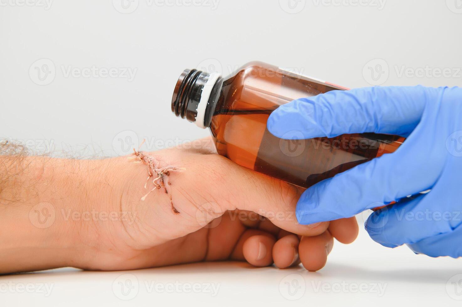 examination by a doctor of a cut on the arm photo