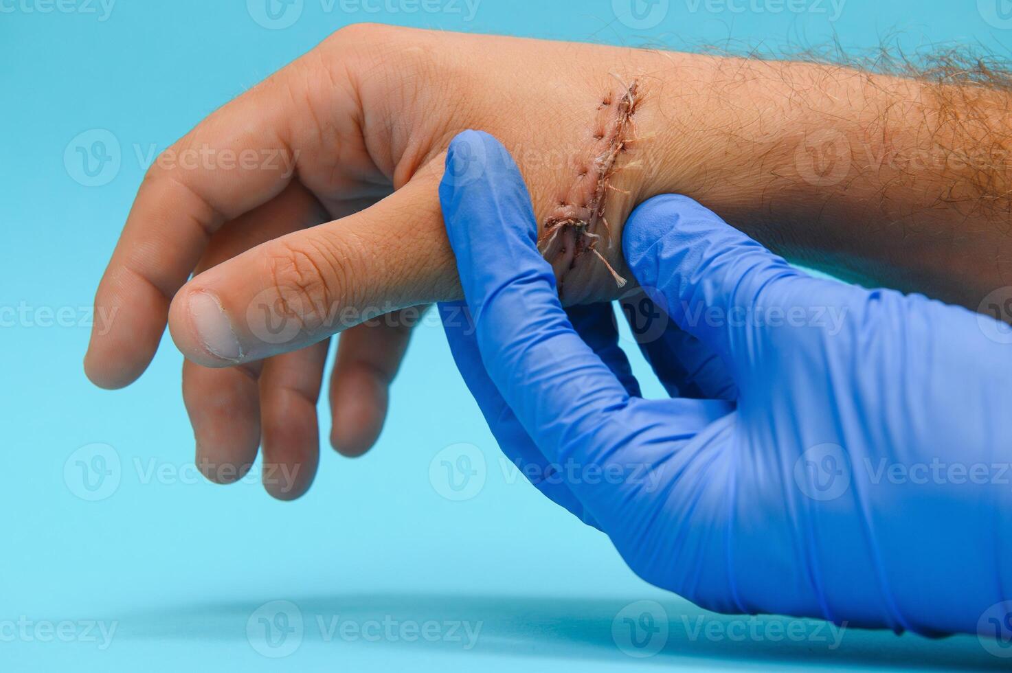 Examination and care of postoperative sutures on the patient's shoulder photo