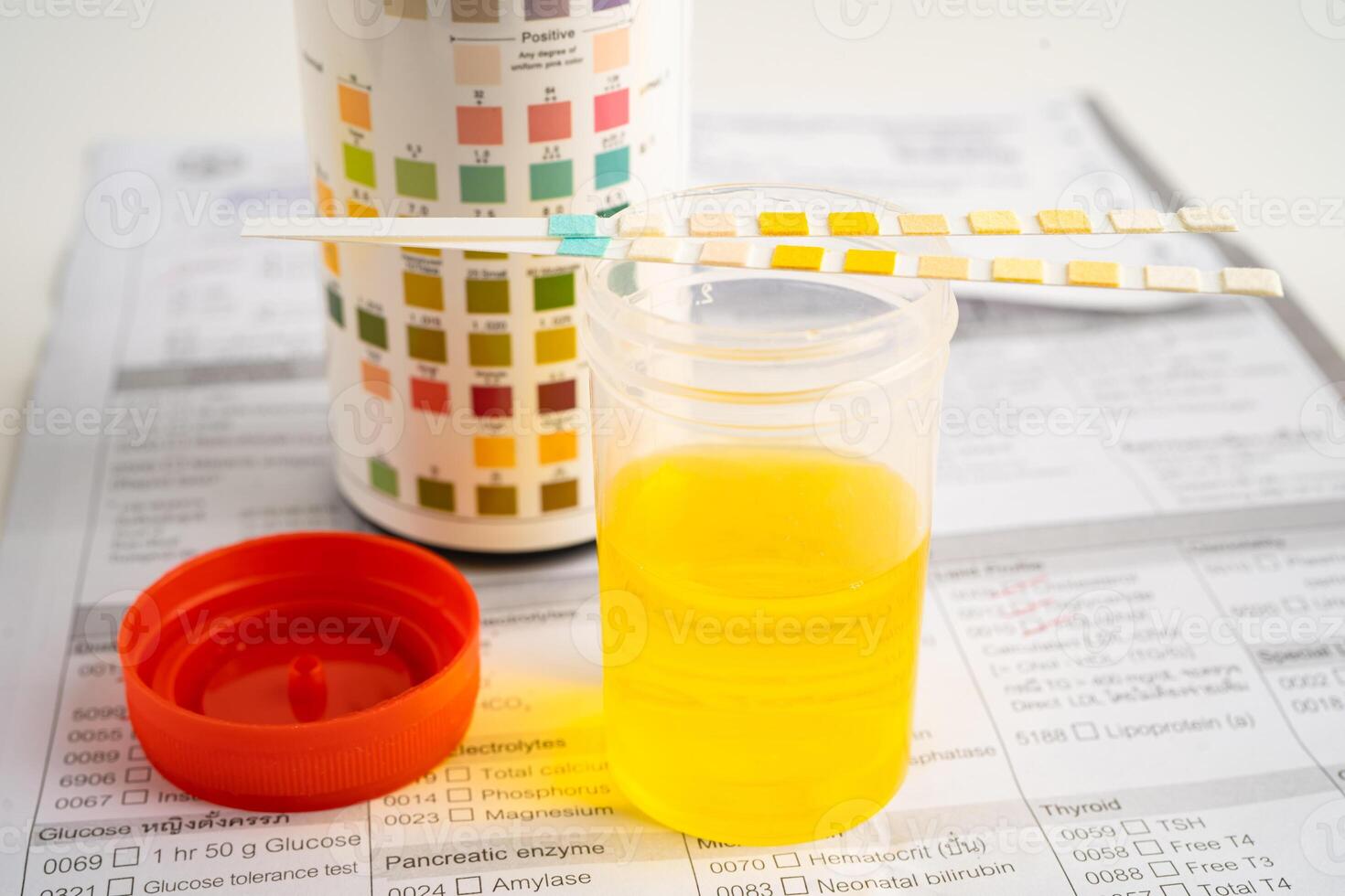 Urinalysis, urine cup with reagent strip pH paper test and comparison chart in laboratory. photo