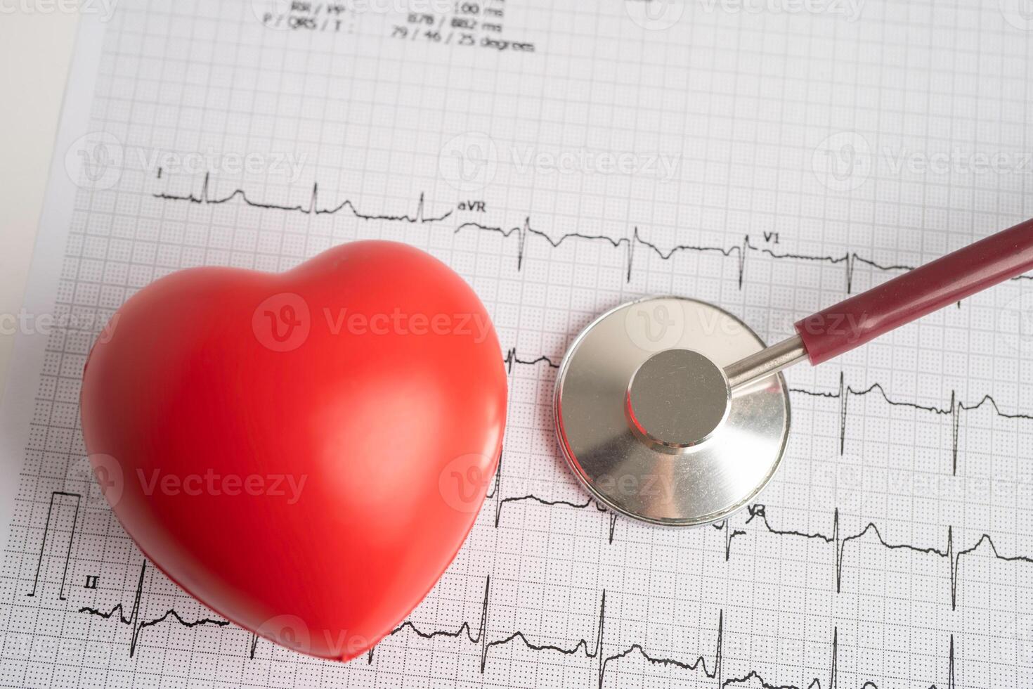 Stethoscope on electrocardiogram ECG, heart wave, heart attack, cardiogram report. photo
