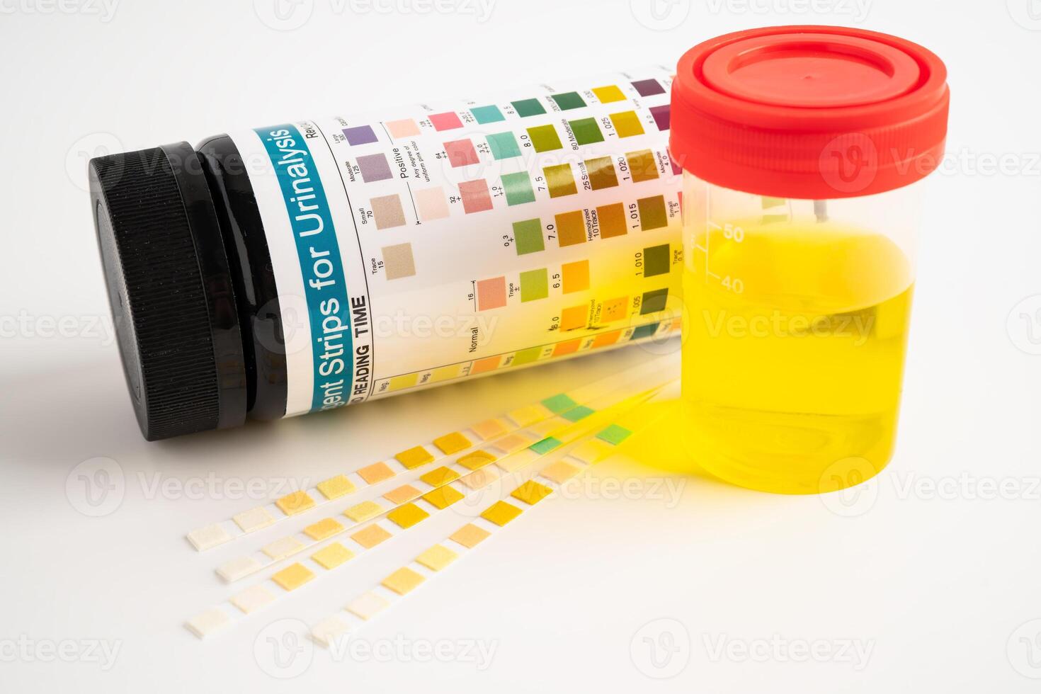 Urinalysis, urine cup with reagent strip pH paper test and comparison chart in laboratory. photo