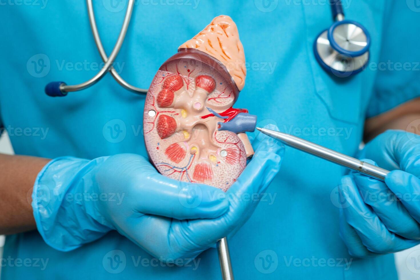 Kidney disease, Chronic kidney disease ckd, Doctor hold human model to treat and study in hospital. photo