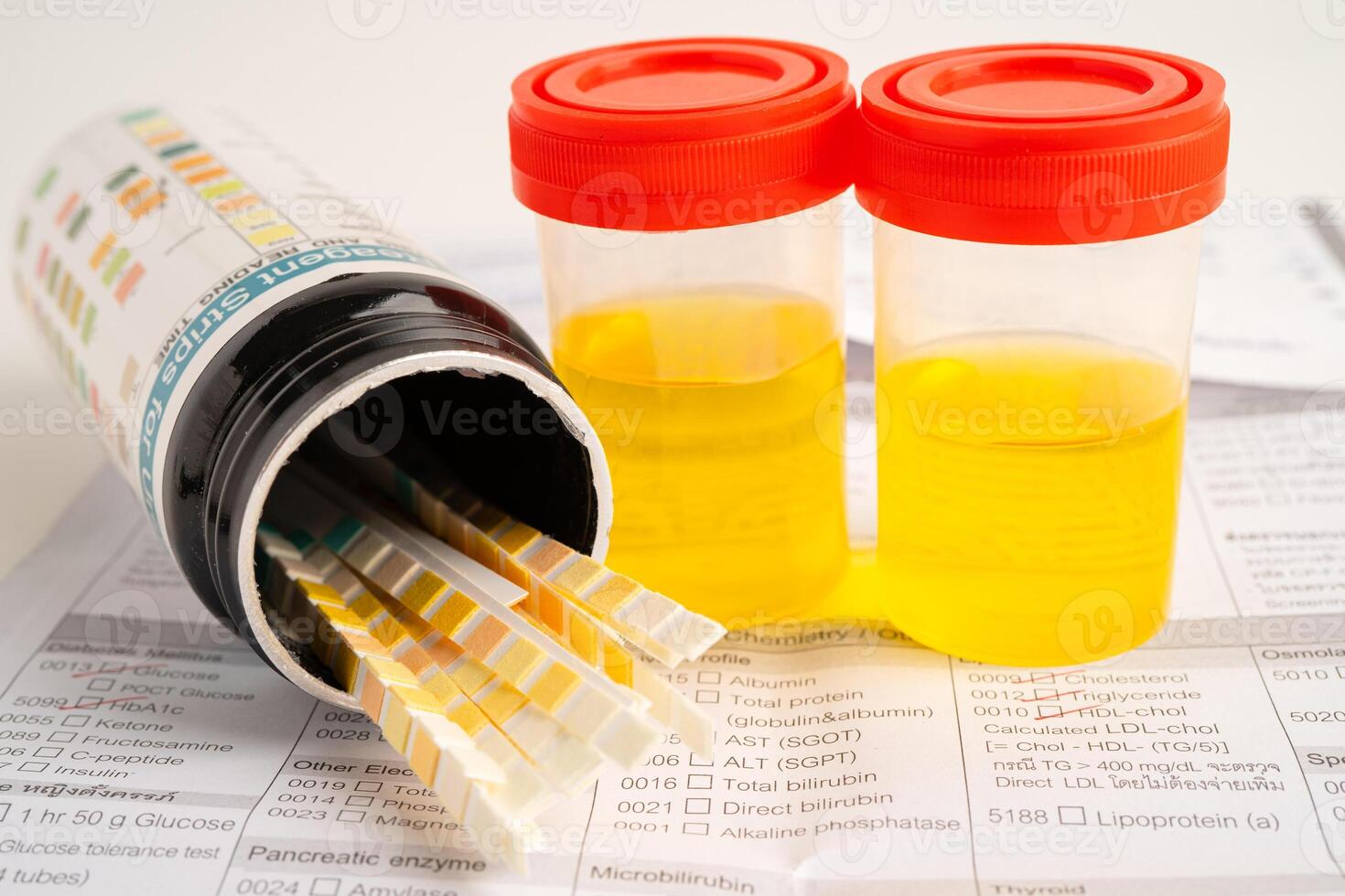 Urinalysis, urine cup with reagent strip pH paper test and comparison chart in laboratory. photo
