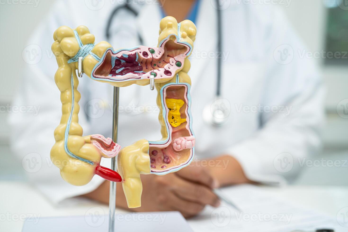Intestine, appendix and digestive system, doctor holding anatomy model for study diagnosis and treatment in hospital. photo