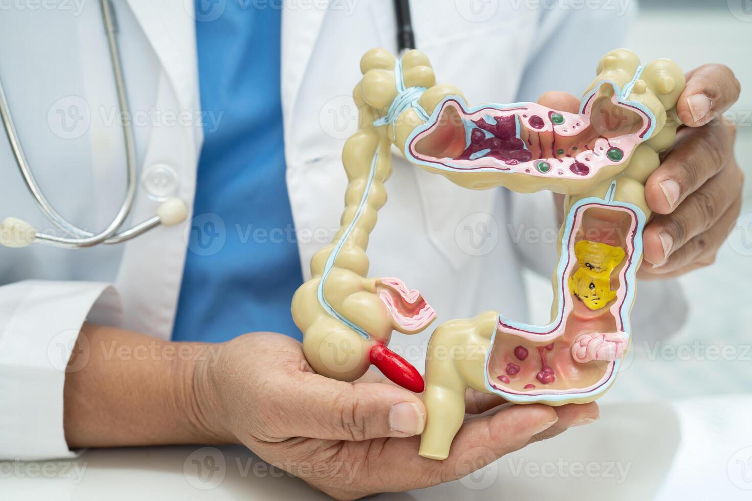 Intestine, appendix and digestive system, doctor holding anatomy model for study diagnosis and treatment in hospital. photo