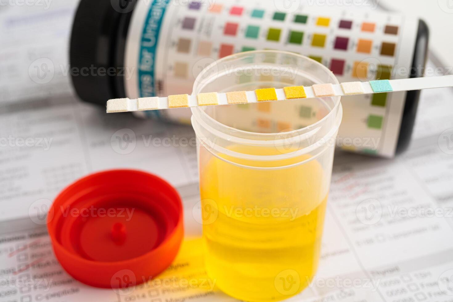 Urinalysis, urine cup with reagent strip pH paper test and comparison chart in laboratory. photo