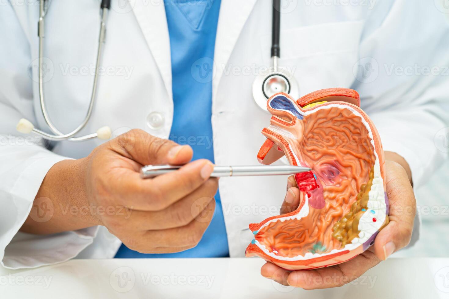 Stomach disease, doctor with anatomy model for study diagnosis and treatment in hospital. photo