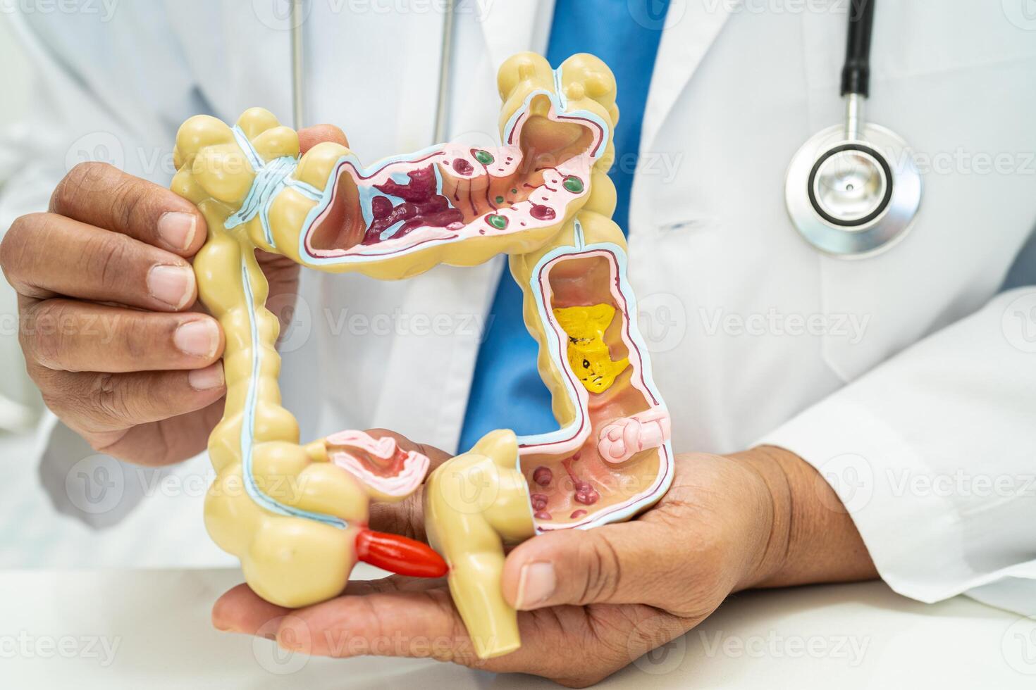 Intestine, appendix and digestive system, doctor holding anatomy model for study diagnosis and treatment in hospital. photo